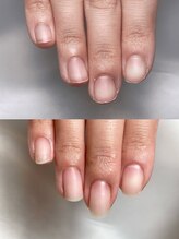 カラー(calla)/本当の爪はこんなにキレイだった