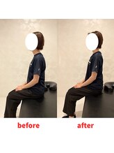 ナオル整体 福岡香椎院(NAORU整体)/20代女性施術事例【猫背改善】