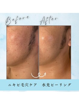 ヘブンビューティー(Heaven Beauty)/