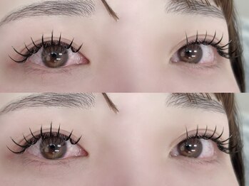 アメリ(AMERI)/エクステ