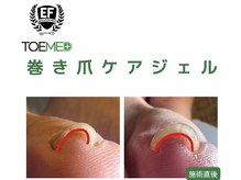 エヌ(N)/巻き爪ケア