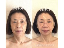 イヴトワエ(eiv Toi et A)/Before After