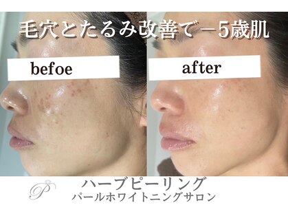 パールホワイトニングサロン 平塚店の写真