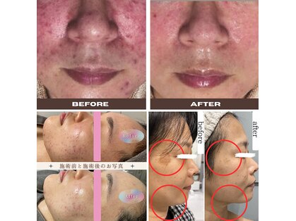 ルルーディア(LOULOUDIA)の写真