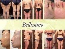 エステサロン ベリシモ(Bellissimo)