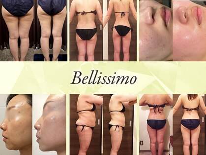 エステサロン ベリシモ(Bellissimo)の写真