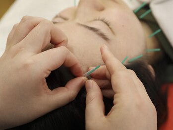 ほねつぎ つくば梅園はりきゅう接骨院/美容鍼灸★真皮からキレイに