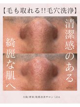 レア(Lea)/男性の方にも人気です＊