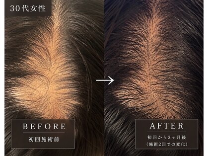 ヘッドサイエンス(HEADSCIENCE)の写真