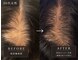 ヘッドサイエンス(HEADSCIENCE)の写真