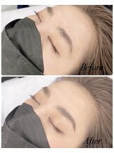 スクーン(SkooN)/ハリウッドアイブロウリフト