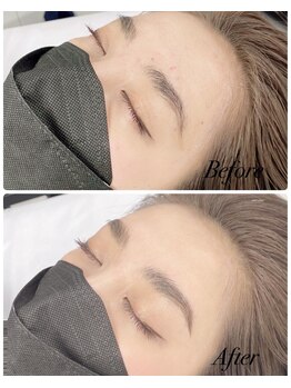 スクーン(SkooN)/ハリウッドアイブロウリフト