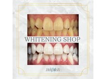 ホワイトニングショップ 尼崎店/ホワイトニング