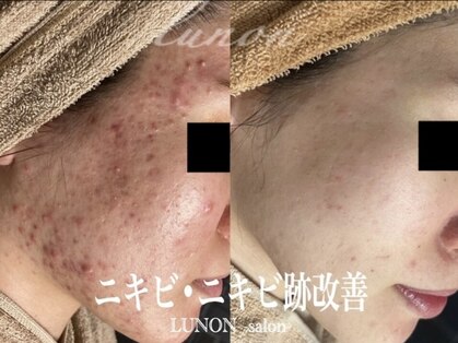 ルノン(Lunon)の写真