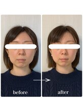 ラリマール/お客様ビフォーアフター