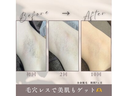 モア トゥインクル 倉敷店(MORE twinkle)の写真