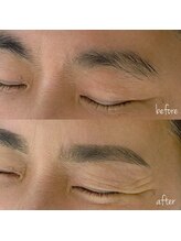 スムーケ 北浦和(smukke)/before/after