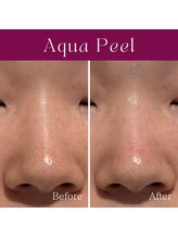 ハナイロ(hana-iro)/アクアピール