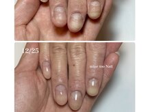 自分ではどうにもできない爪のお悩みも一緒に解消しましょう！