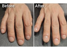 ガシー(GASY)/ネイルケア