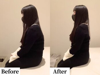 ソレア(Solea)/姿勢改善1回目 Before/After