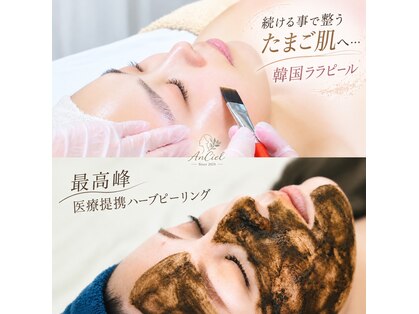 名東区/肌管理/肌質改善ハーブピーリング AnCiel【アンシエール】の写真
