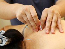 よしおか鍼灸院/