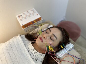 サクセスボックス 神戸元町(SUCCESS BOX)の写真/どうしてもリフトアップしたいあなたに《素敵美容鍼¥5200》お悩みや部位に合わせて鍼の細さも使い分け◇