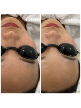 リアム(LiAm)/第4世代ララピール