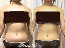 ラナンスパ(RANUN SPA)/週１エステで無理ないダイエット