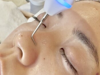 ハチ(8)の写真/【毛穴の黒ずみ/角栓に】ハイドラフェイシャルで毛穴汚れをごっそり除去！クリアなお肌に導きます♪