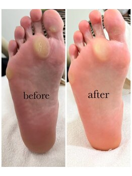 リゼラアンドコー 宇都宮陽南店/ドイツ式フットケア専門店