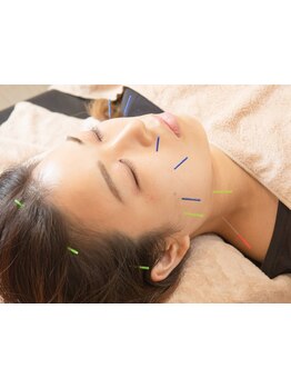 鍼灸施術を受けたい