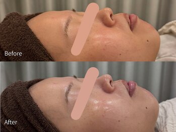 アウラ 小杉店(AULA)/