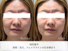 アストリエ グレース 相模大野(Astorie Grace)/1回でもリフトアップ！