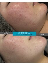 ケア(CARE)/クリスティーナ