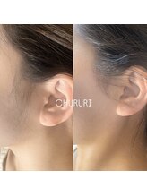 チュルリ 天満橋店(Chururi)/【もみあげ】ワックス脱毛