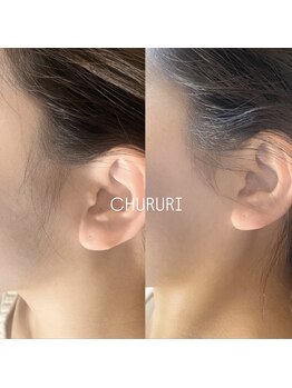 チュルリ 天満橋店(Chururi)/【もみあげ】ワックス脱毛