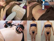 スリムグラシアナ 大橋駅前店(SlimSpa Graciana)の雰囲気(脂肪冷却で直接脂肪にアプローチ。EMSキャビ・SPクラッシャー)