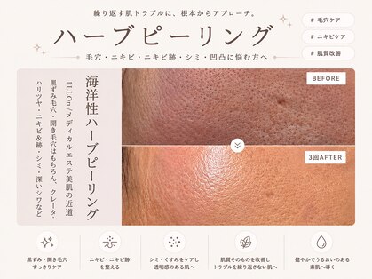 クラルテアンドコー(Salon Clarte&Co.)の写真