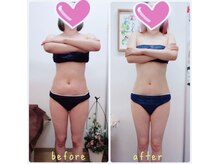 アーズ(A-Z)/骨盤美脚+キャビゼロ痩身