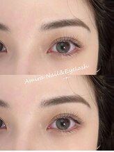 アミーラ(Amira)/フラットラッシュ