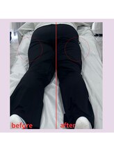 ルナ(Runa)/美容整体◆1回の効果