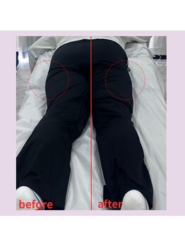 ルナ(Runa)/美容整体◆1回の効果