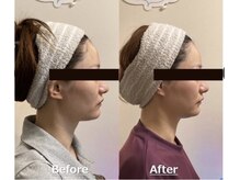 小顔22 ボルティ 本店(Bolty)/小顔シンメトリー矯正＆全身矯正