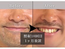 エルモリア(ELMOREA)の雰囲気（【メンズ専門】最新メンズ脱毛特化型で効果抜群脱毛が可能♪）