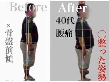 リスタート腰痛整体院 舟入院/症例9:40代男性　腰痛