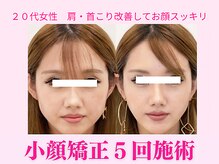 ワンモア 新町店(1+MORE)