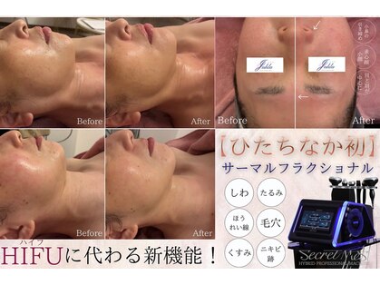 ユフラ(Juhla)の写真