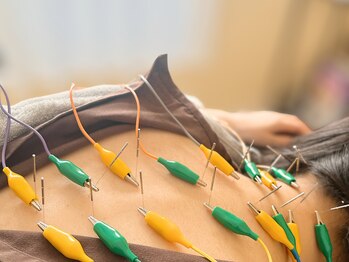 耀 カガヤキ/自律神経への電気鍼